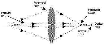 Spherical aberrations result in paraxial and peripheral rays having different foci.