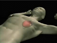 Simulated heart surgery